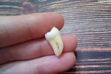 К чему снится выпадение зубов