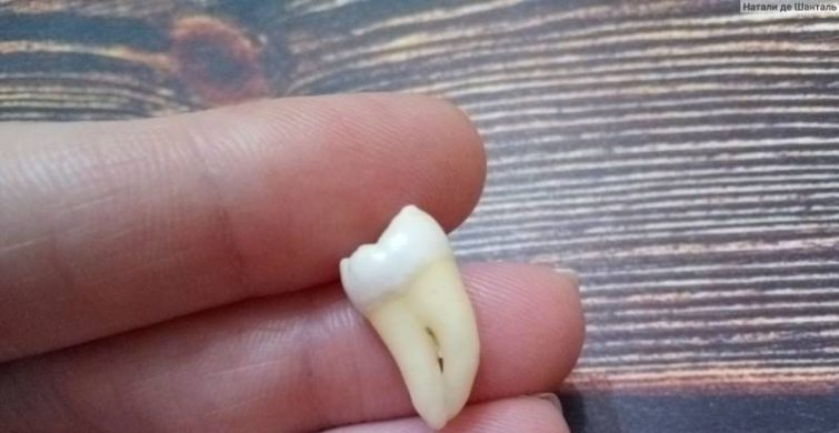 К чему снится выпадение зубов