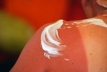 Солнце, SPF и страх перед старением: как защитить кожу и душу