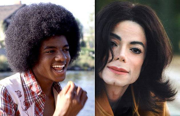 Почему Майкл Джексон сменил цвет кожи?