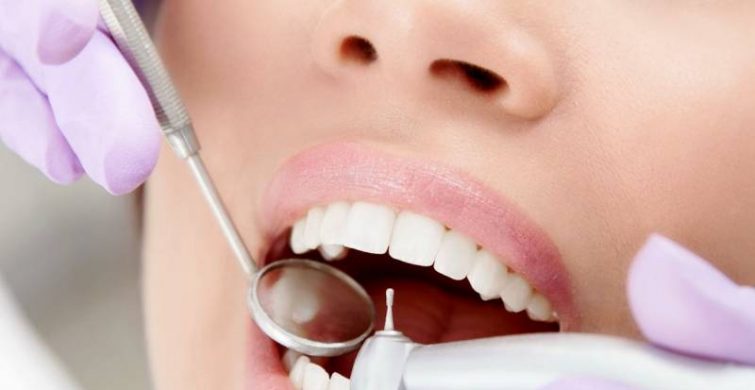Как бороться с кариесом: процесс лечения проблем с зубами itemprop=