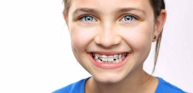 Детская пластина для зубов: Справочник для родителей